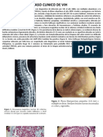 Caso Clinico de Vih