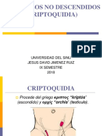 Testiculos No Descendidos (Criptoquidia)