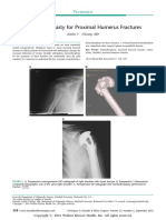 Hemiarthroplasty for Proximal Humerus Fractures