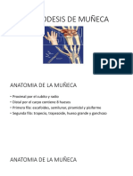 Artrodesis de Muñeca Presentacion