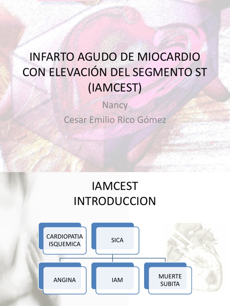 Iamcest | PDF | Infarto de miocardio | Electrocardiografia