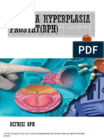 Benigna Hyperplasia Prostat