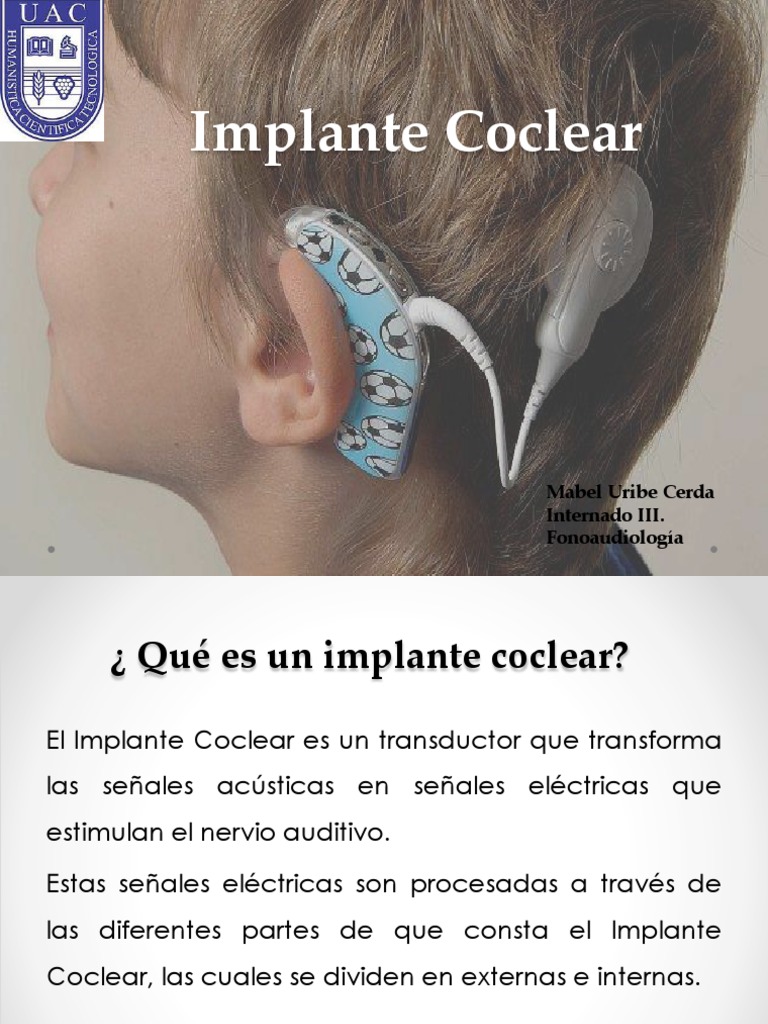 Guía sobre el Implante Coclear | PDF | Medicina CLINICA | Medicina