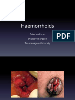 Haemorrhoids: Peter Ian Limas Digestive Surgeon Tarumanagara University