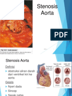 Stenosis Aorta