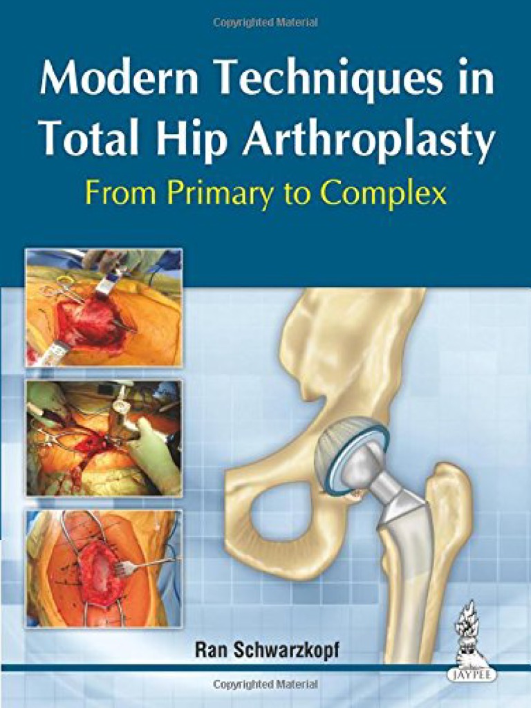 Modern Techniques in Total Hip Arthroplasty ;From Primary to Complex Medicine Medical