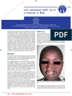 Experiences With Unilateral Cleft Lip in A Humanitarian Mission in Mali
