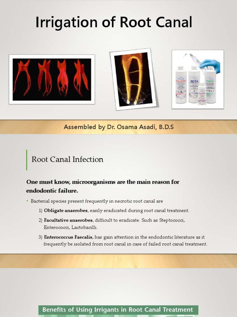 Irrigation of Root Canal Assembled by Dr. Osama Asadi, B.D.S PDF