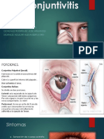 Conjuntivitis