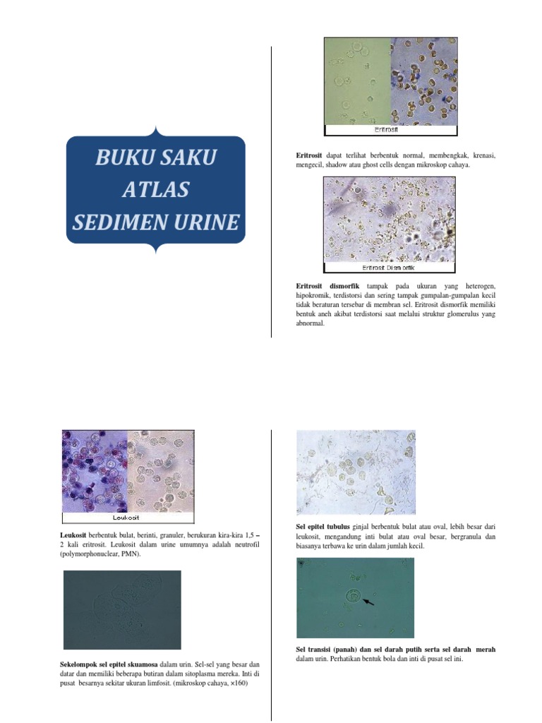 Analisis Sedimen Urine dan Eritrosit | PDF