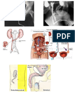 Trauma Uretra