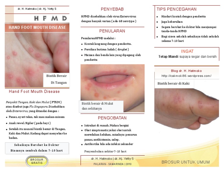 Brochure Hand Foot and Mouth Disease
