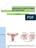 Total Vaginal Hysterectomy On Uterine Prolapse With Huge Fibroid