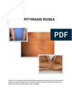 Pityriasis Rosea