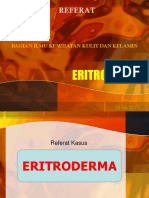 Referat Eritroderma