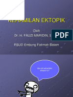 Kehamilan Ektopik PPT