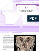Análisis Cefalométrico en Norma Frontal PDF