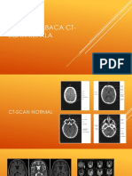 Cara Membaca Ct-Scan Kepala