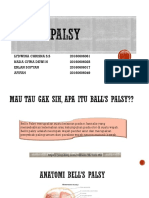 bells palsy