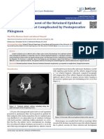 Surgical Management of The Retained Epidural Catheter Fragment Complicated by Postoperative Phlegmon