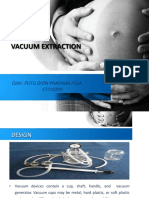 Vacuum Extraction: Oleh: Putu Dion Pratama Puja 17710209