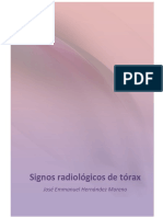 Signos radiológicos de patologías pulmonares