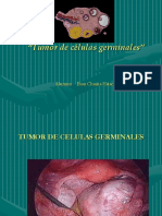 Tumor de Celulas Germinales.ppt