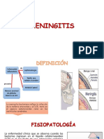 Meningitis