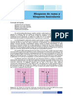 ECG BLOQUEOS RAMA.pdf