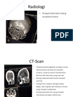 Radiologi Metastase Tumor