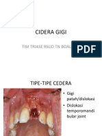 Cidera Gigi