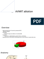 AVNRT