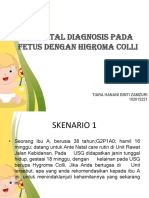 Prenatal Diagnosis Pada Fetus Dengan Higroma Colli: Tiara Hanani Binti Zamzuri 102015221