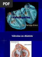 Valvulopatias