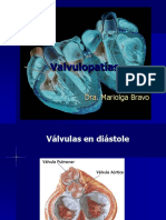 Valvulopatias