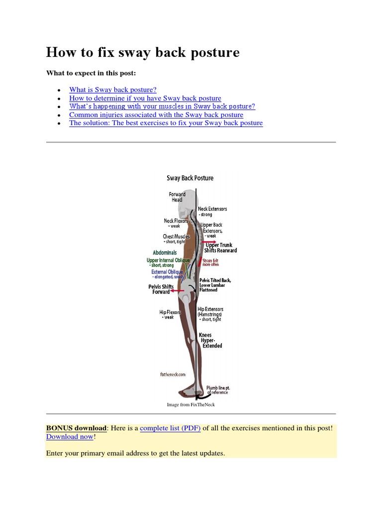 How To Fix Sway Back Posture PDF Pelvis Hip
