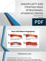 Angioplasty Dan Stenting Pada Intracranial Atherosclerosis