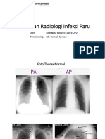 Gambaran Radiologi Infeksi Paru