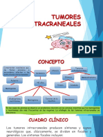 TUMORES INTRACRANEALES