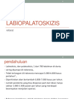 Labiopalatoskizis