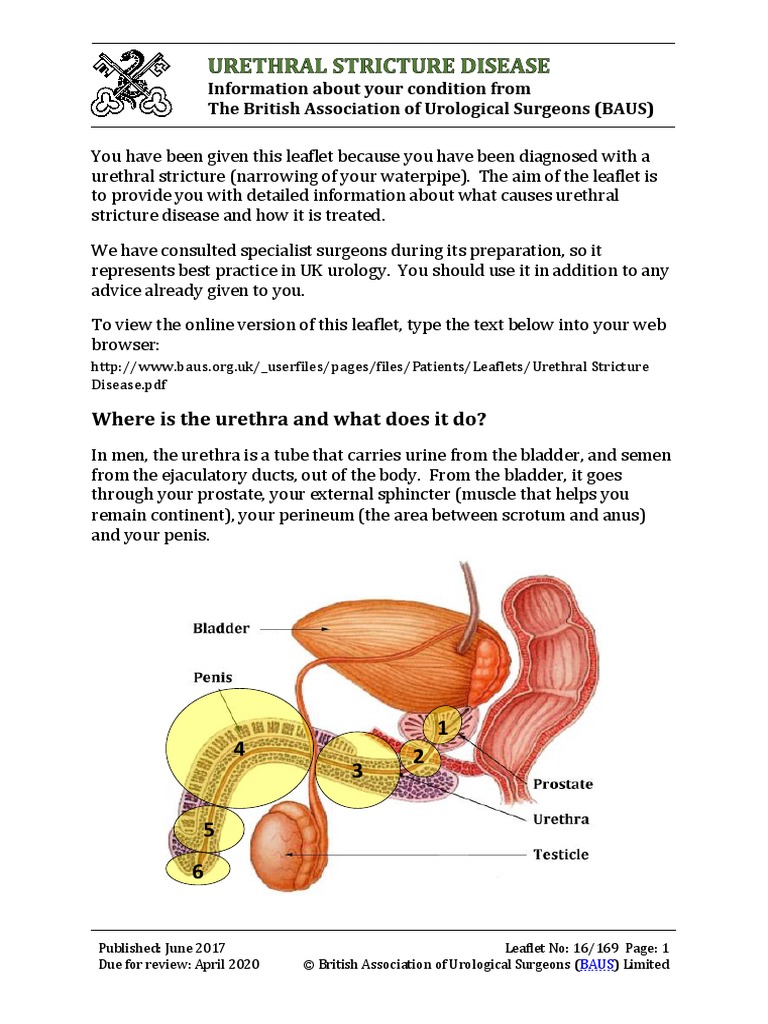 Urethral Stricture Disease | PDF | Urology | Urinary System