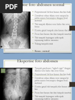 Hasil Rontgen Genu dan Cruris Normal | PDF