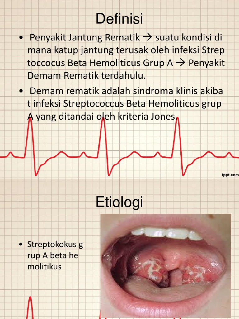 Rheumatic Heart Disease