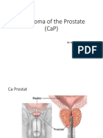 Carcinoma of The Prostate (Cap) : Dr. Nurul Akbar, Sp.U