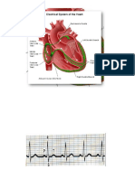 EKG