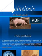 Triquinosis