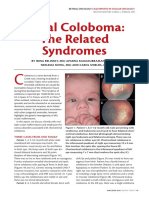 Uveal Coloboma: The Related Syndromes