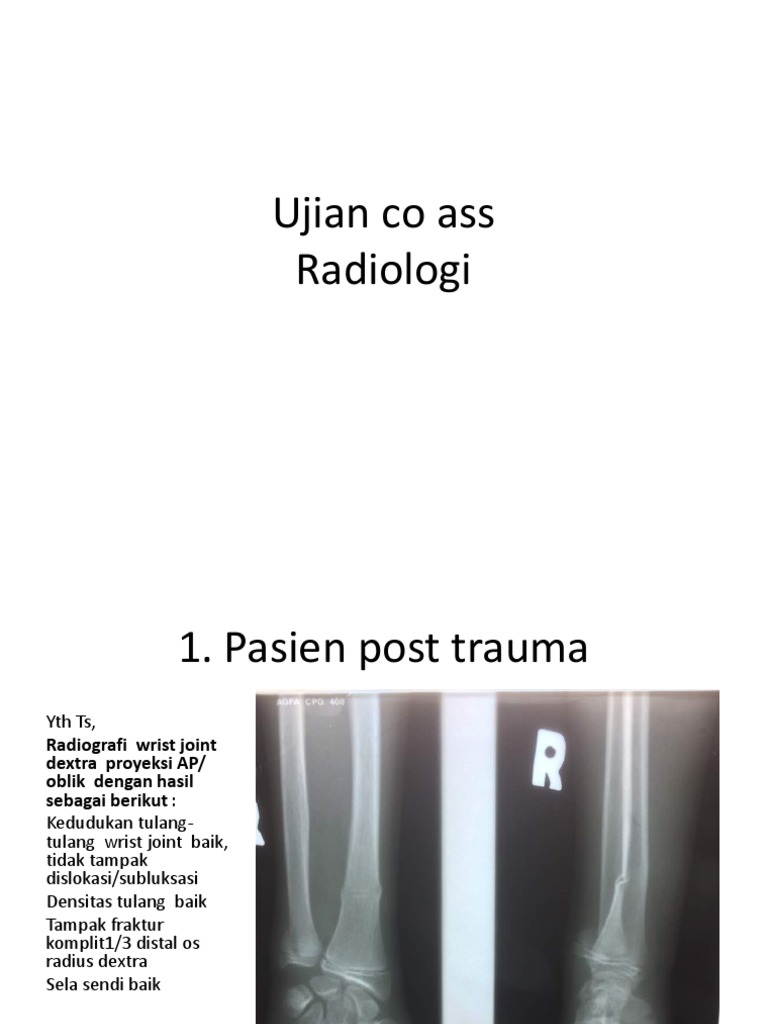 Fraktur Radius Dextra pada Trauma Wrist | PDF | Perjalanan | Sains ...