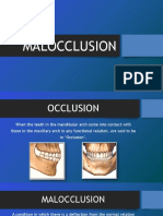 Malocclusion: by Umaima Ahmed Roll. No. 79, 2 Year BDS