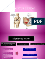 Penatalaksanaan Fisioterapi Pada Knee Joint